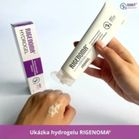 RIG_aplikace_hydrogel.jpg