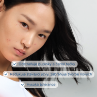 3701129805367_Sebium_Kerato+_30ml4_benefity