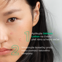 3701129811948_Sebium_Lotion_200ml6_pouziti
