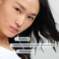 3401360106994_Sebium_Sensitive_30ml4_benefity