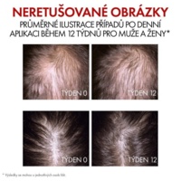 Vichy-Website-CZ-PDP-Regen-_NEW_3337875932080-4