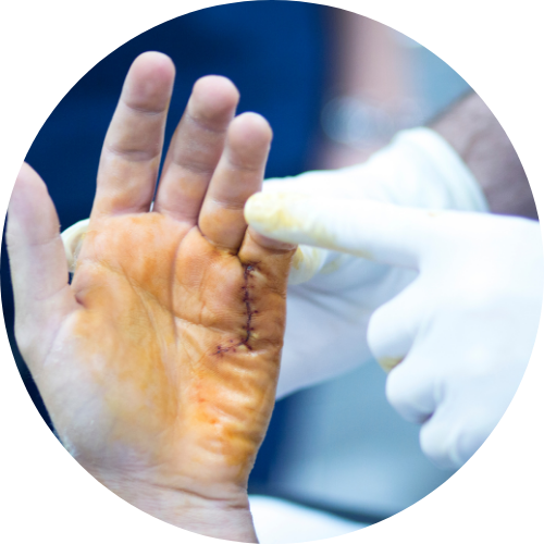 clisodine-antisepticky-roztok-dezinfekce-operace
