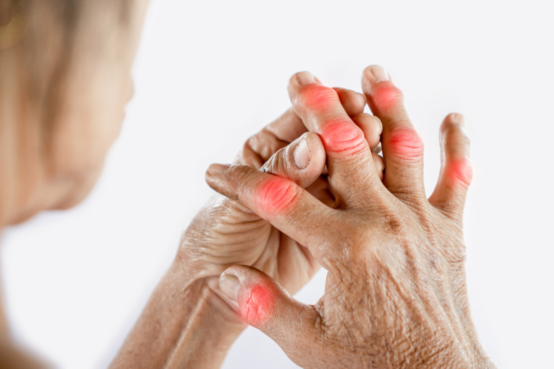 7b