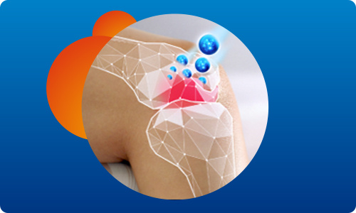 Voltaren_Forte_08_banner_Rich_content_CZ_500x300px