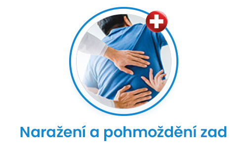 pohmozdeni zad